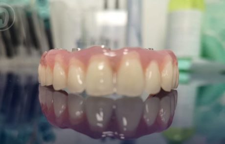 Fast & Fixed - Reabilitare orală totală într-o singură ședință(2)